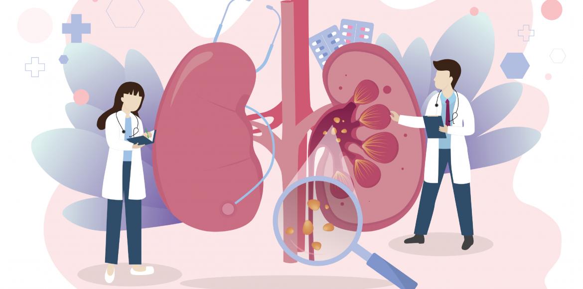 Bacteria discovered in the most common kidney stones
