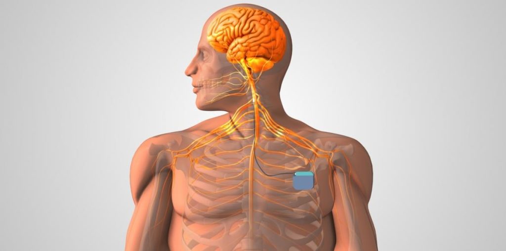Vagus nerve: soon an implant against depression?


