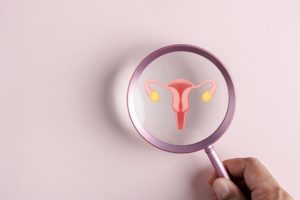PCOS, SMOP: ovarian or metabolic disease?