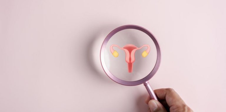 PCOS, SMOP: ovarian or metabolic disease?


