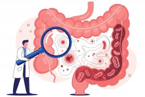 Parkinson’s: an intestinal signature detected