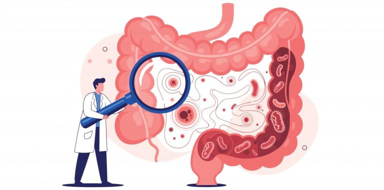 Parkinson’s: an intestinal signature detected


