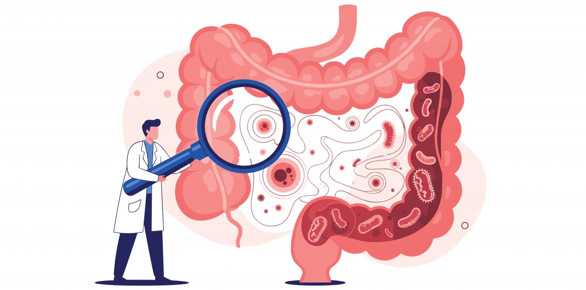 Parkinson’s: an intestinal signature detected
