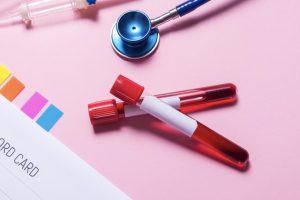 Functional medicine: 4 markers to watch and why